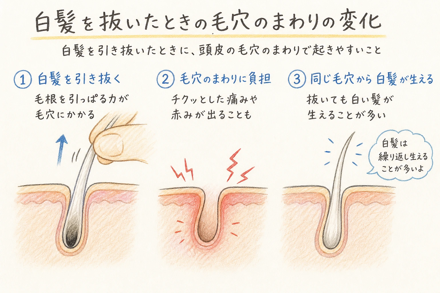 白髪を抜いたときの毛穴のまわりの変化|白髪を引き抜いたときに、頭皮の毛穴のまわりで起きやすいこと